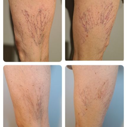 medico chirurgo estetico novara botox filler