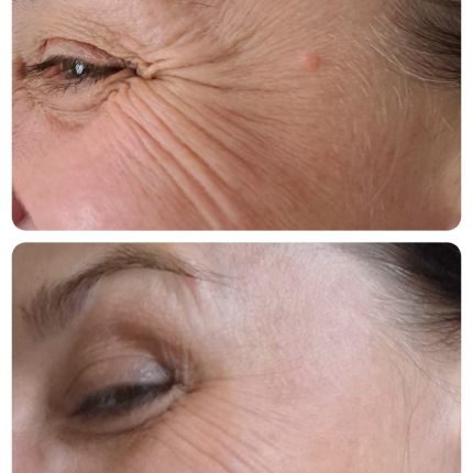 medico chirurgo estetico novara botox filler
