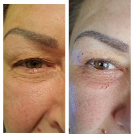 medico chirurgo estetico novara botox filler