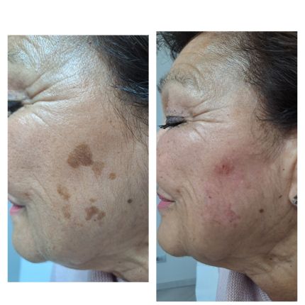 medico chirurgo estetico novara botox filler