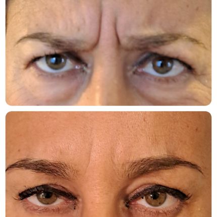 medico chirurgo estetico novara botox filler