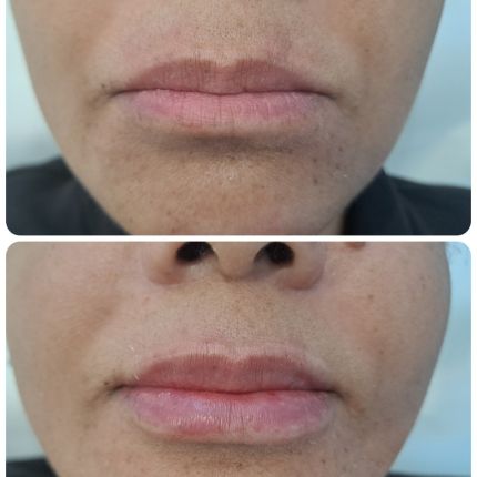 medico chirurgo estetico novara botox filler
