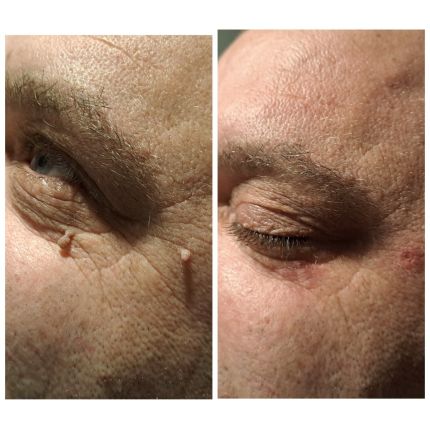 medico chirurgo estetico novara botox filler