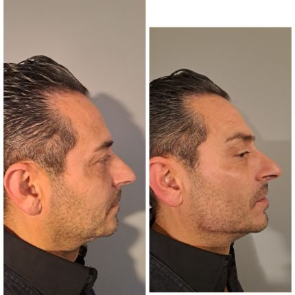 medico chirurgo estetico novara botox filler