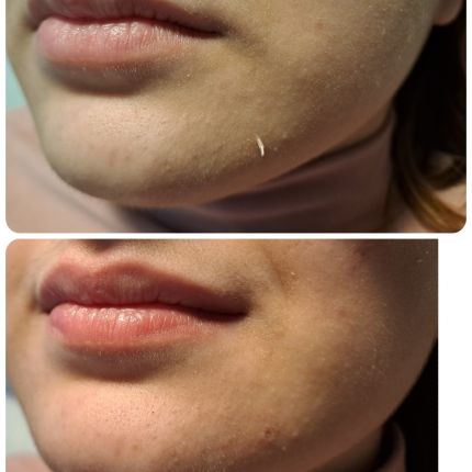 medico chirurgo estetico novara botox filler